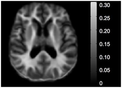 Sex moderates the association between age and myelin water fraction in the cingulum and fornix among older adults without dementia